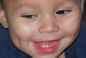 teeth and dimples smile